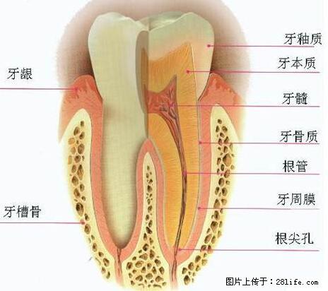 牙齿做了根管治疗装了牙套后悔死（此帖给牙病患者看） - 生活百科 - 桂林生活社区 - 桂林28生活网 www.28life.com