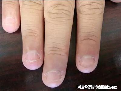 剪指甲、挖耳屎，这些日常小动作竟隐藏大危害！ - 生活百科 - 桂林生活社区 - 桂林28生活网 www.28life.com