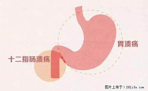 男孩12岁就切掉半个胃！碗筷不能这么用，东西不能这么吃… - 美食天地 - 桂林生活社区 - 桂林28生活网 www.28life.com