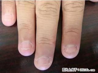 剪指甲、挖耳屎，这些日常小动作竟隐藏大危害！