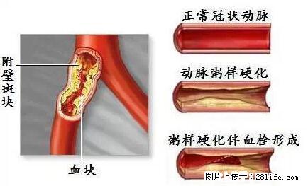 原来海带不能乱吃…现在知道还不晚哦！ - 生活百科 - 桂林生活社区 - 桂林28生活网 www.28life.com